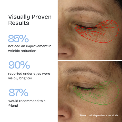 Kiyss Micro Needling Infusion Patches