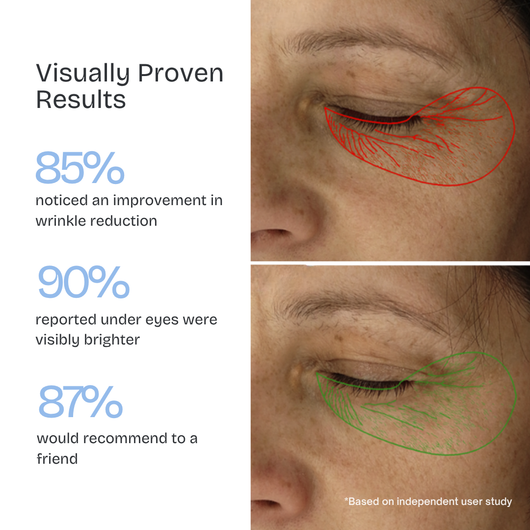 Kiyss Micro Needling Infusion Patches