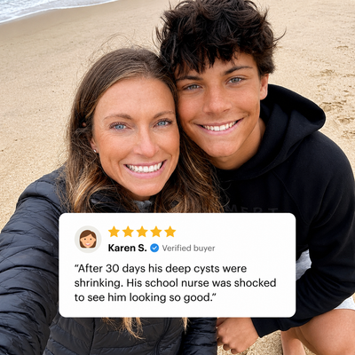Kiyss Gut-Skin Probiotic For Teen Acne