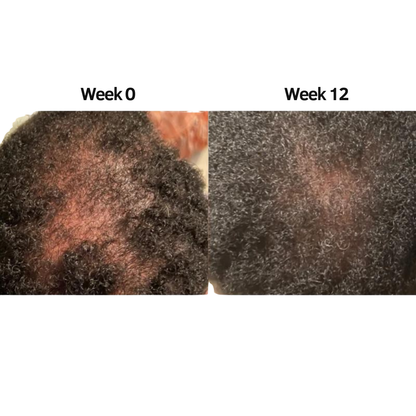 Kiyss Stimulating Scalp and Hair Balm
