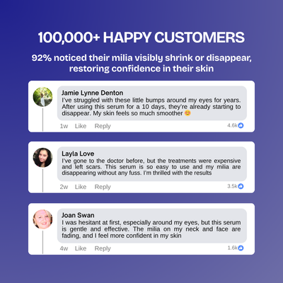 Kiyss Milia Remover Serum