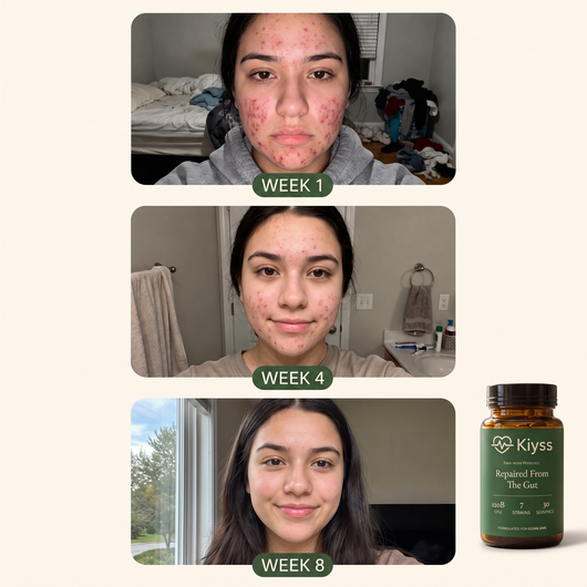 Kiyss Gut-Skin Probiotic For Teen Acne